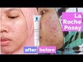 Review La Roche Posay Effaclar Duo Plus  Ampuh Menghilangkan Jerawat