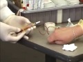 venipuncture procedure butterfly