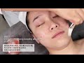 cherrycur management video dermabell therapy