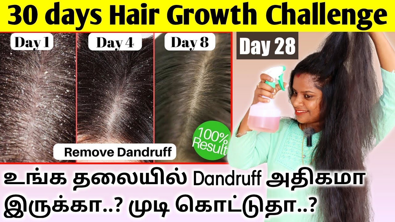 🤗காரணம் இல்லாமல் முடி கொட்டுதா..? Hair Growth Booster Easy Spray to scalp / Faster hair growth