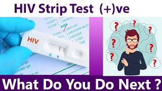 HIV strip test POSITIVE Next ??? ( Q\u0026A - 8 )