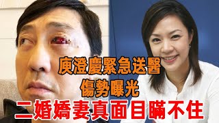 庾澄慶緊急送醫！結婚6年，被榨乾2.6億，二婚小嬌妻真面目終於瞞不住！#庾澄慶 #張嘉欣 #伊能靜 #庾澄慶病情 #星聞有爆點