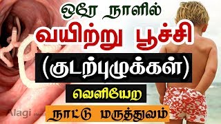 ஒரே நாளில் வயிற்று பூச்சி ( குடற்புழுக்கள் ) வெளியேற மருத்துவம் | stomach worms Home remedy