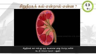 1_12 சிறுநீரகக்கல் பற்றிய தகவல்