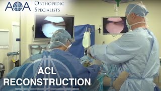 AOA Orthopedic Specialists - Dr. John Drkulec - ACL Reconstruction