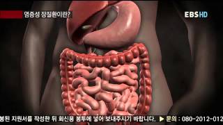 명의 - Best Doctors_염증성 장질환, 소화기내과 김원호 교수_#001