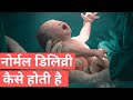 Normal Delivery Kaise Hoti Hai | Normal Delivery In Jaipur | Dr. Mayuri Kothiwala