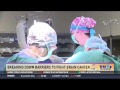 KTHV: Dr. Ali Krisht Discusses Breaking Down Brain Surgery Barriers