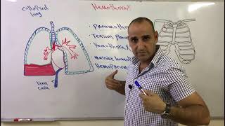 اصابات الصدر المدمى Hemothorax and massive hemothorax