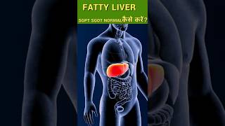 how to reverse fatty liver | SGPT,SGOT कैसे कम करें |#fattyliver #fattylivertreatment