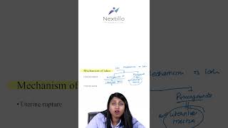 Mechanism Of Labor | Dr. Vedi | MBBS, OBGY (MS) | #Nextillo