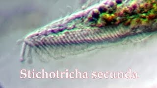 Stichotricha secunda ! close up