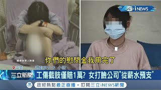 有這麼摳的公司嗎? 工傷截肢僅賠1萬 受傷女子再爆料\