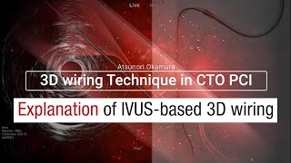 【Japanese】Explanation of IVUS-based 3D wiring