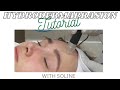 Hydrodermabrasion Tutorial | How To Perform Hydrodermabrasion | Hydro Soline 4-in-1 Facial Expert