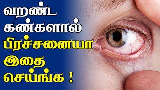 வறண்ட கண்கள் இருக்க அப்போ இந்த tips உங்களுக்குதான்