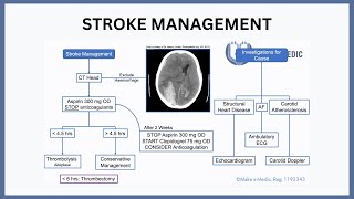 Stroke Management Explained