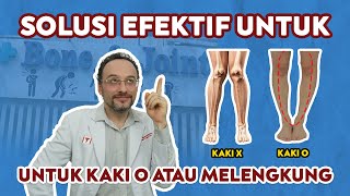 🔴 SOLUSI EFEKTIF UNTUK KAKI O ATAU MELENGKUNG