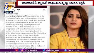 Tollywood Actress Samantha Suffered from Myositis Disease | Revealed on Social Media |