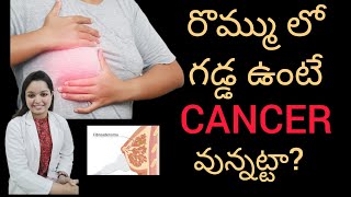 రొమ్ము లో గడ్డలు ఎందుకు వస్తాయి? Causes of breast lumps ? రొమ్ము లో గడ్డలు ఉంటే క్యాన్సర్ వున్నట్టా?