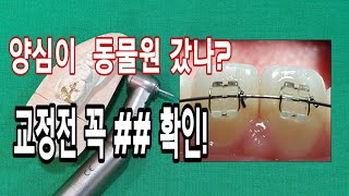 교정치료전 치료할 ##를 확인해야 안 망합니다.!