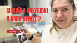 🩵🩷 VÉGE AZ ELSŐ TRIMESZTERNEK! 🤰🏼 Vajon sikerült megtudni hogy fiú vagy kislány lapul odabent?🩷🩵