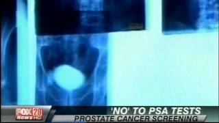 New Recommendations for Prostate Cancer Screenings