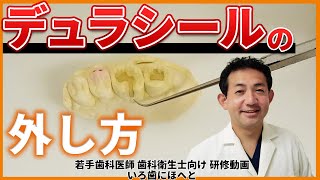 【デュラシール（仮封）の外し方】Ⅰ級・Ⅱ級窩洞をそれぞれ解説