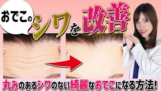 【女医が教える】おでこのシワをなくす方法！シワの原因はその習慣！