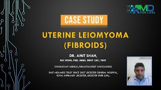 Case Study: Uterine leiomyoma| Fibroids| MDforLives| Dr Amit Shah oncologists |Healthcare