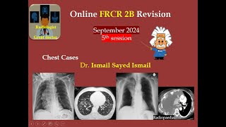 FRCR 2b Session 5 -September 2024 -Chest