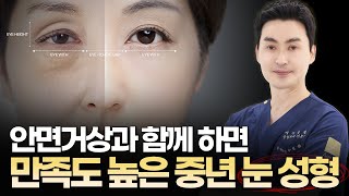 😉안면거상과 같이 하면 좋은 상안검, 하안검 수술_중년 눈성형 총정리!【에이징엘】