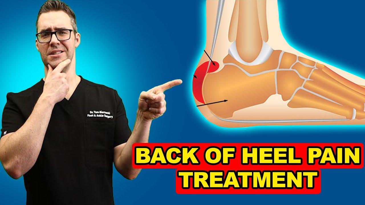 Heel Bursitis: Causes And Treatment Treat My Achilles, 41% OFF