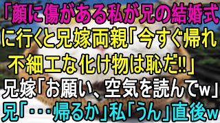 【スカッとする話】兄の結婚式に行くと顔に傷がある私に兄嫁両親「不細工な化け物は恥！帰れ！」兄嫁「空気を読んでｗ」→兄「…帰るか」私「うん」直後、衝撃のサプライズがｗ