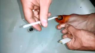 Чем лечить ногти пораженные от псориаза