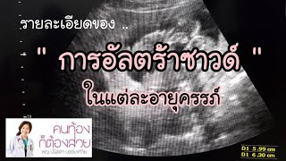 รายละเอียดของการอัลตร้าซาวด์ในแต่ละอายุครรภ์ | DrNoon Channel