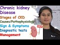 Chronic Kidney Disease | Stages of CKD | Causes | Symptoms | Diagnose | Management