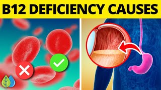 Top 8 Causes of B12 Deficiency