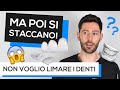 Faccette dentali: cosa sono?