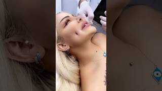 Shocking ...New Dimple hacks 😱#makeuphacks #shorts #youtubeshorts