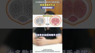 阴茎增粗的方法都有哪些？ 医学科普 男性 增粗 硬核健康科普行动