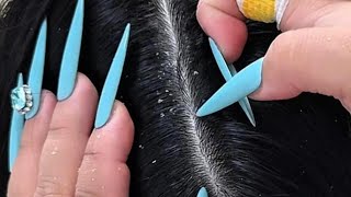 ASMR Scalp Cleaning with Nails and Wooden Comb | So Satisfying