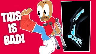 Tyrone BROKE HIS LEG!
