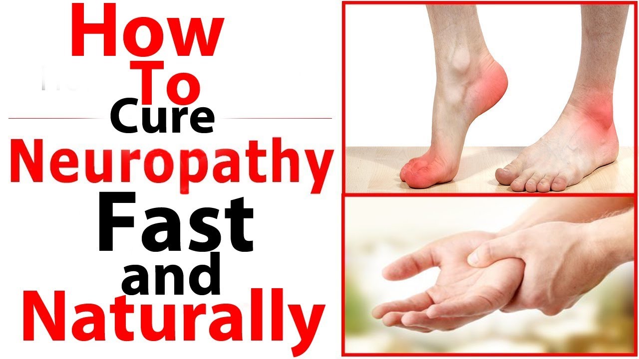 10 Ways To Cure Neuropathy Fast And Naturally/How To Cure Peripheral ...