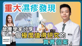 重大濕疹發現：營養學家分享 ｜一個極度值得研究的真實個案