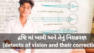 દ્રષ્ટિ ની ખામી અને તેનું નિરાકરણ defects of visions and their correction આંખની ખામી ઓ સમજાવો?RJ