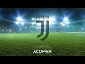 Acumen Media | A Moment With Juventus