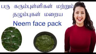 முகப்பரு தழும்பு மற்றும் கரும்புள்ளி மறைய Neem face pack