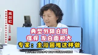 典型外阴白斑瘙痒 发白面积大 专家：坐浴困难这样做