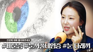 눈 질환에 대한 세 가지 궁금증 - 나는의사다 803회